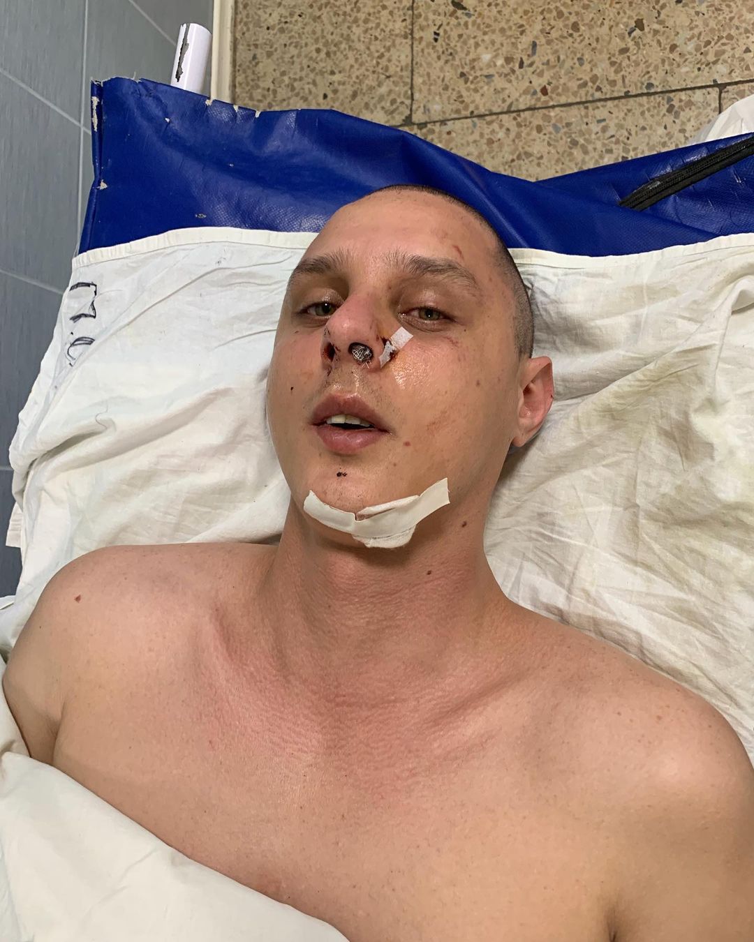 В Киеве жестоко избили автора хитов KAZKA (фото)